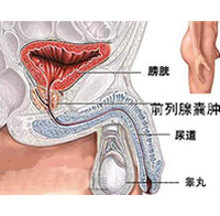 360°全面解析：前列腺囊肿